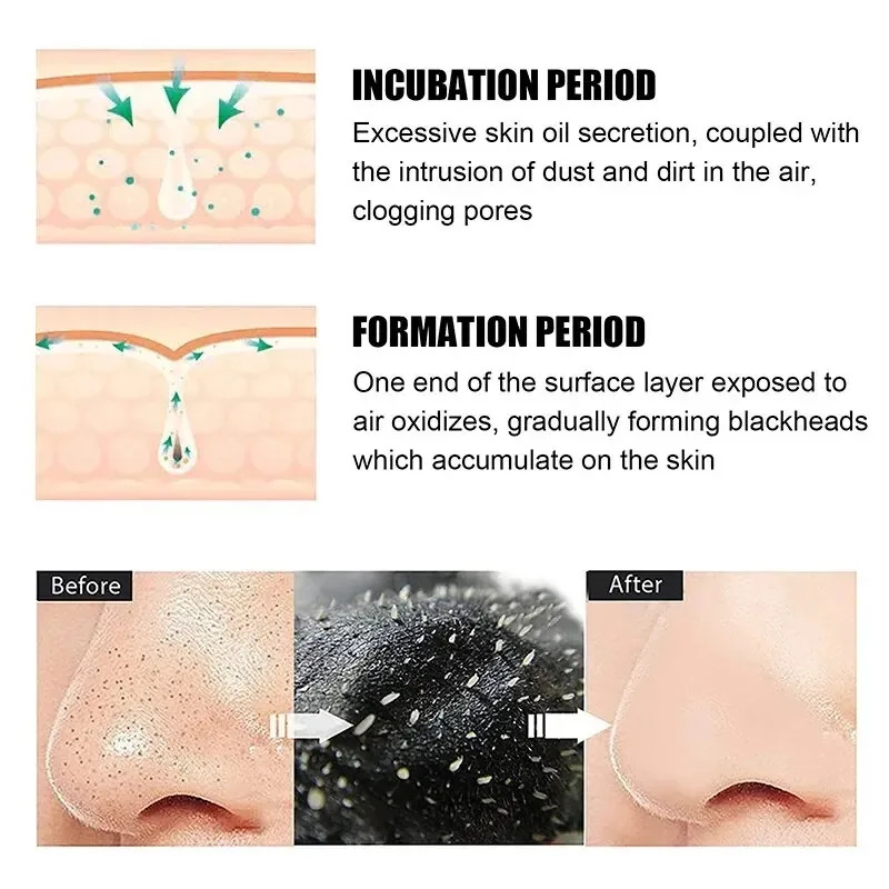 10/150PCS Blackhead Remove Mas - огляд і ціна Charcoal Pore Strip