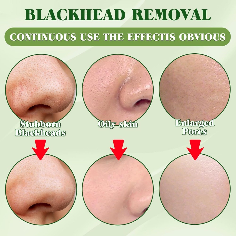 15 Pack Charcoal Blackhead Rem - огляд і ціна Charcoal Pore Strip